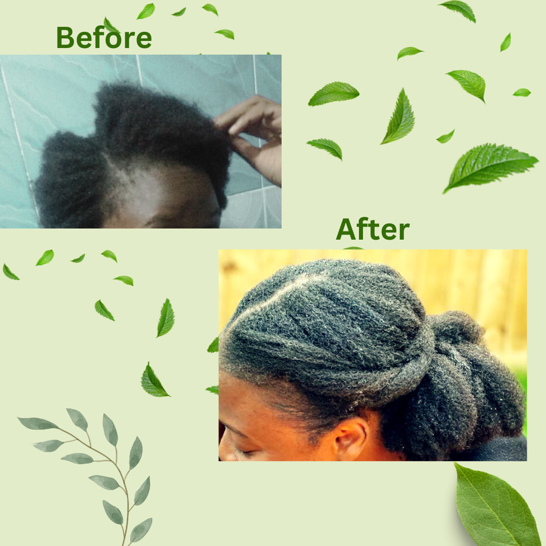Ayurvedic Hair Growth Oil || 100% Natural Oils and Herbs for Dandruff & Hair Loss Treatment.